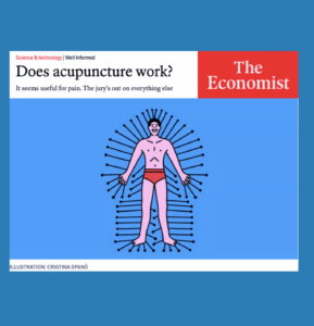 Economist article Does acupuncture work?