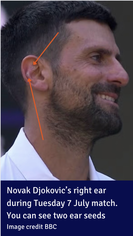 Novak Djokovic ear seeds